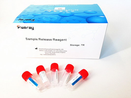 ISO 13485の鼻の標本PCRの検出のウイルスのRNAの小型キット
